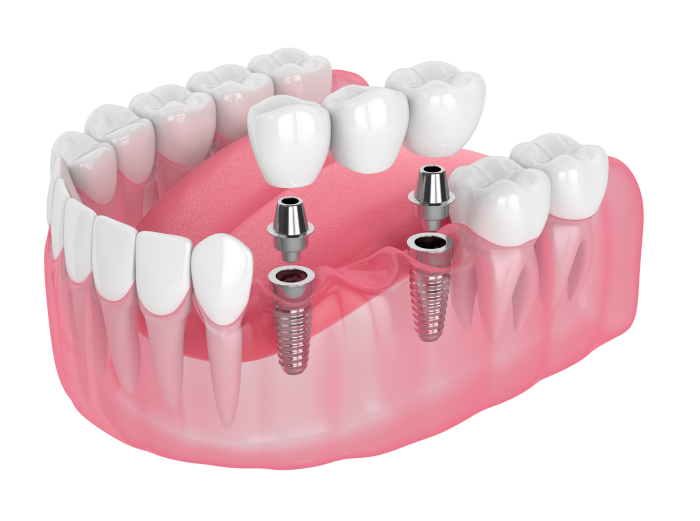 veritasdentalcare-dental-care-logo