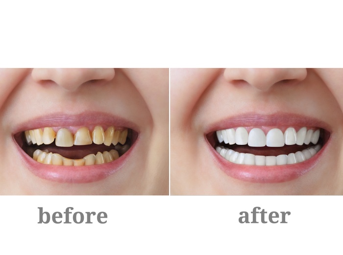 veritasdentalcare-dental-care-logo