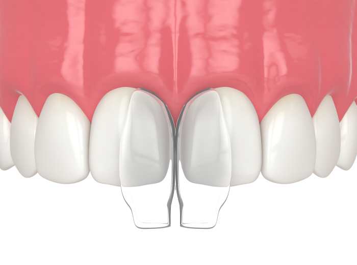 veritasdentalcare-dental-care-logo